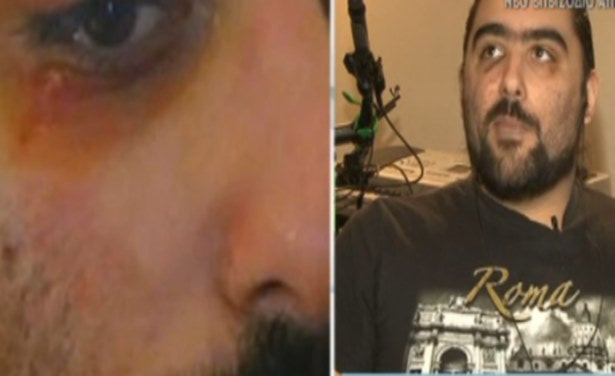 Ξυλοδαρμός φοιτητή στη Θεσσαλονίκη από Αναρχικούς:  Τι αποκαλύπτει – Βίντεο